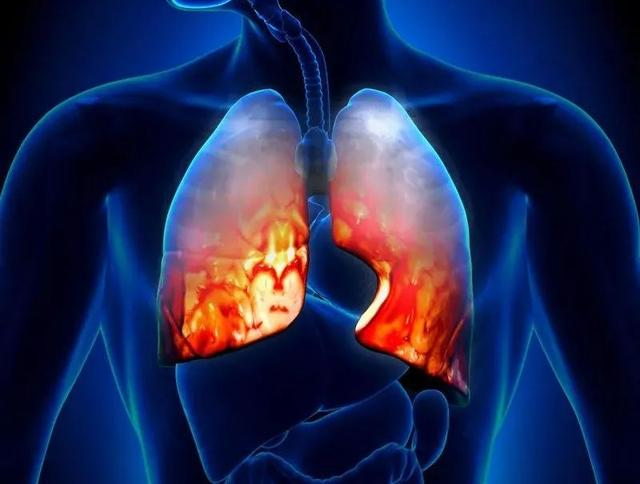 肺部结节怎么治疗