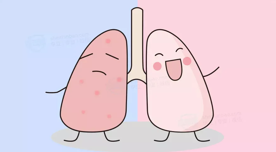 肺结节吃什么药能散结 肺结节吃什么药能散结