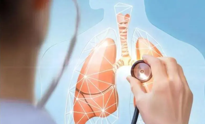 肺结节怎么治疗