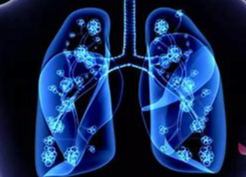 肺有结节怎么办