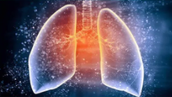 肺结节怎么治疗