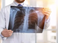 肺部有结节是怎么回事？要紧吗?