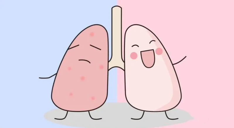 肺结节吃什么食物散结节最快 肺结节吃什么食物散结节最快