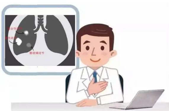 肺有结节怎么办