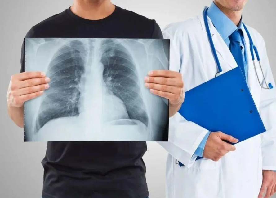 肺有结节怎么办