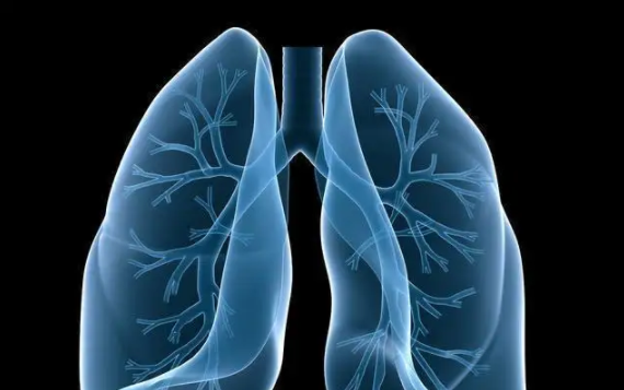 肺结节,肺部结节需要治疗吗
