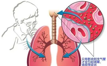 肺部有结节是怎么回事?要紧吗? 肺部有结节是怎么回事?要紧吗?