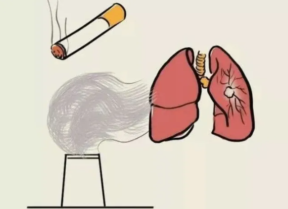 肺部结节形成原因 肺部结节形成原因