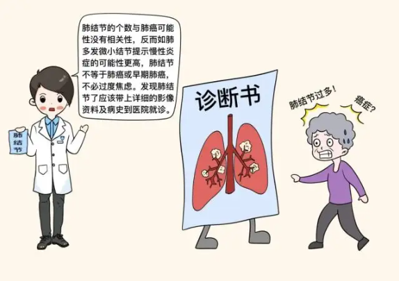 肺结节是什么意思 肺结节是什么意思