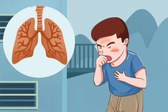 肺结节怎么治疗