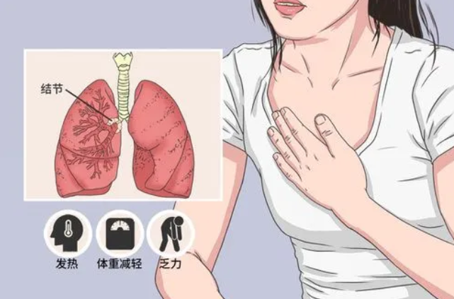 肺部结节形成原因 肺部结节形成原因