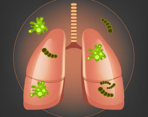 肺部结节最怕三个征兆