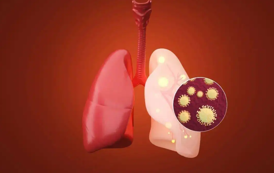 肺有结节怎么办