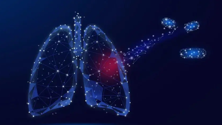 肺有结节怎么办