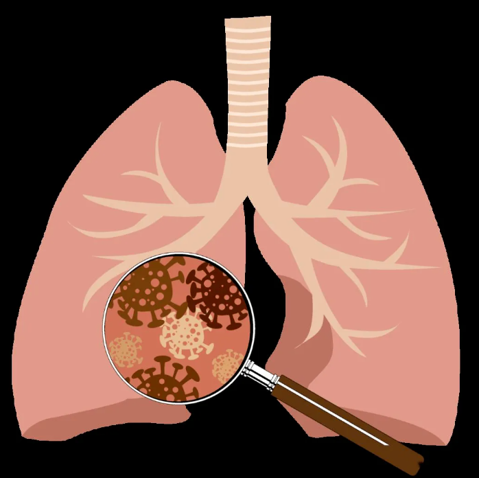 肺部结节