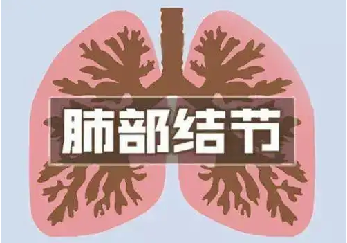 肺结节病