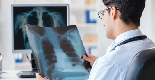 肺结节怎么治疗