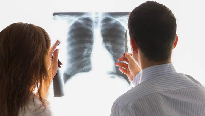 肺结节怎么治疗