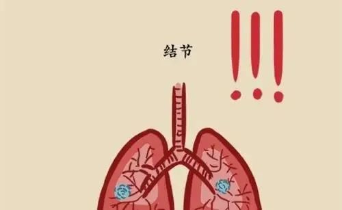 肺部小结节 肺部小结节
