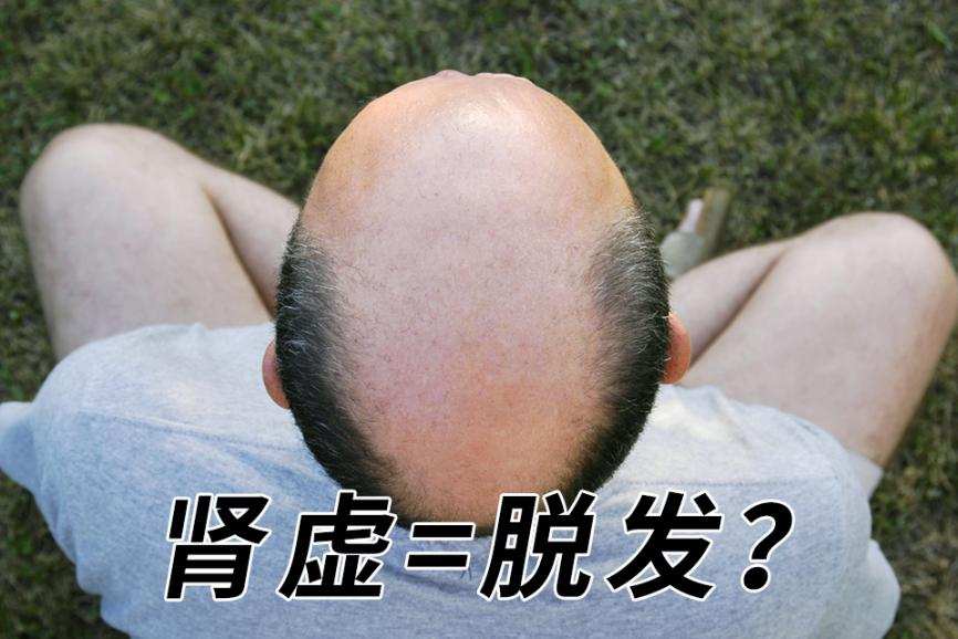 肾虚脱发 肾虚脱发