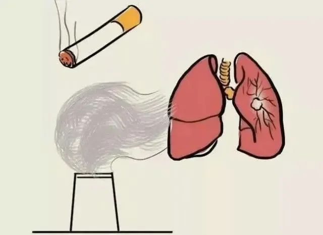 肺部结节 肺部结节