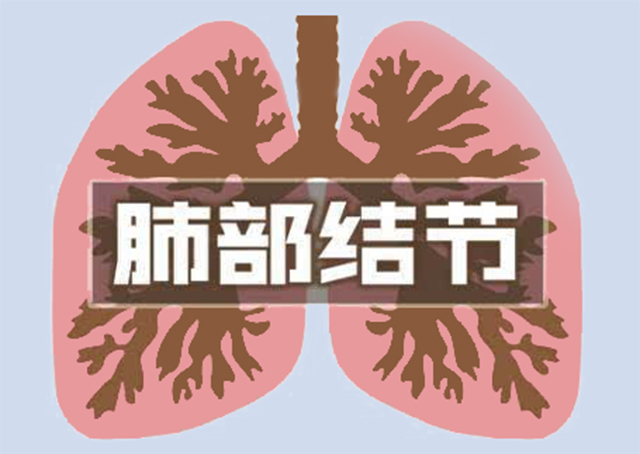 肺部结节