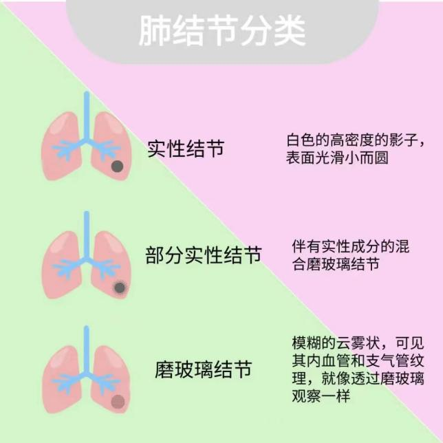 肺部结节 肺部结节