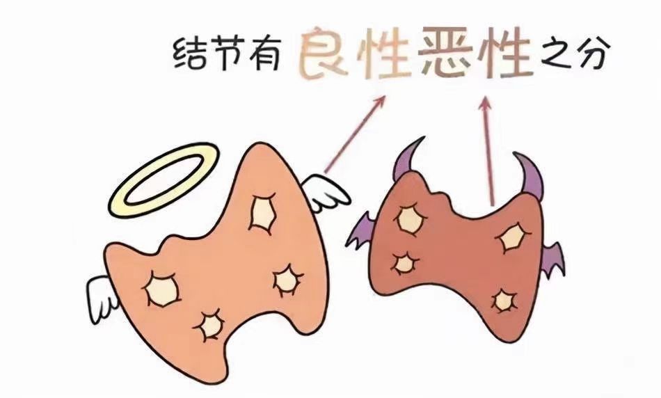 磨玻璃结节 磨玻璃结节