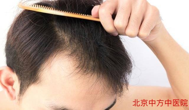 肾虚脱发 肾虚脱发