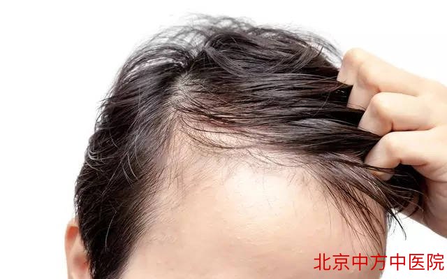 肾虚脱发 肾虚脱发