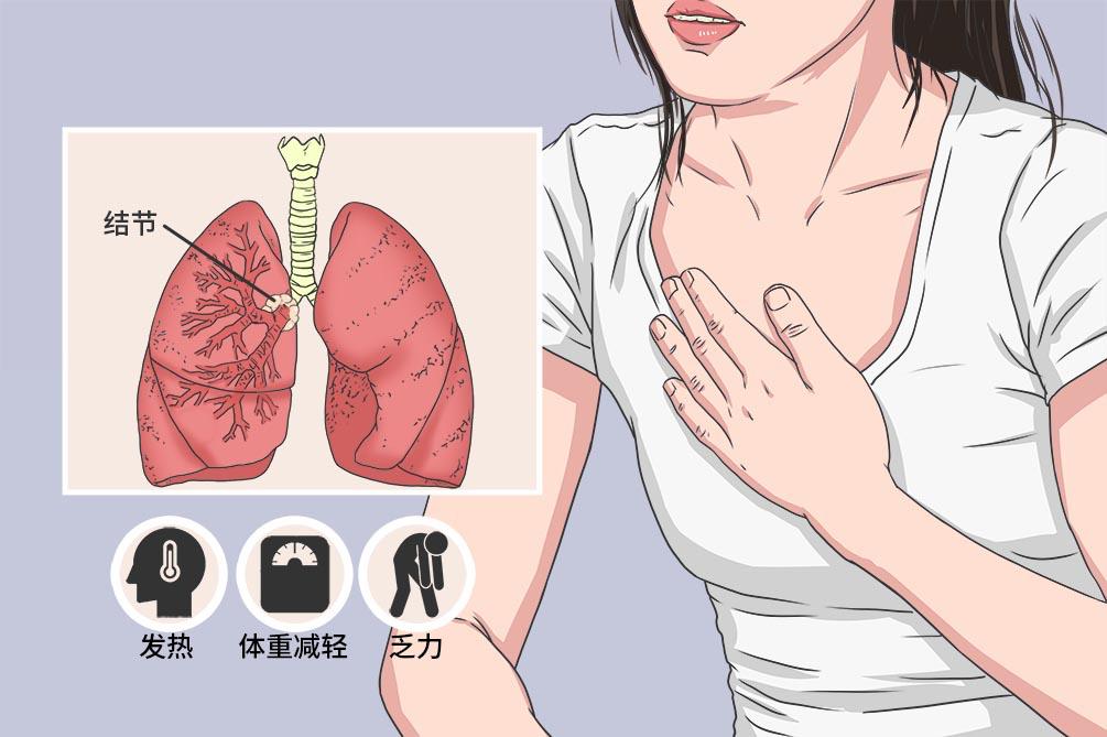 肺结节能消吗 肺结节能消吗