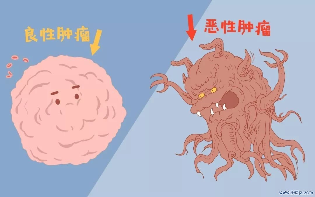 肺部结节 肺部结节