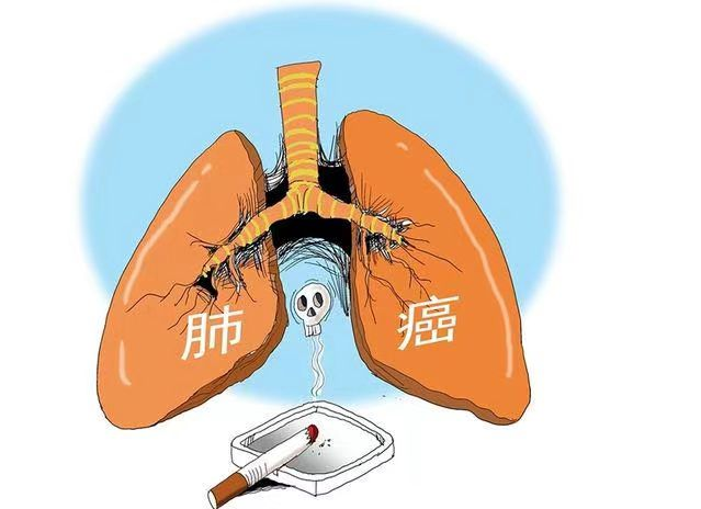 肺部结节 肺部结节
