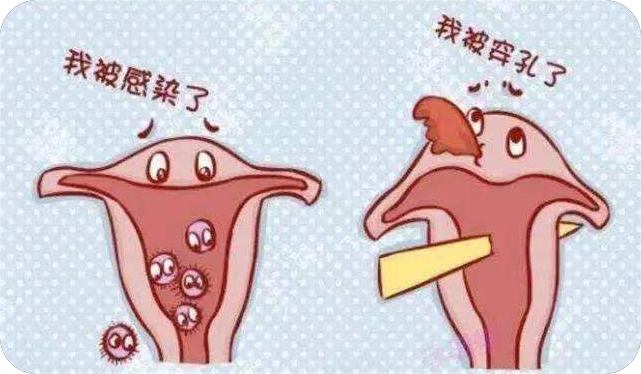 输卵管不通 输卵管不通