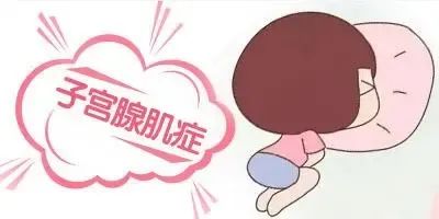 子宫腺肌症 子宫腺肌症