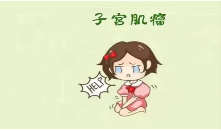 子宫肌瘤 子宫肌瘤