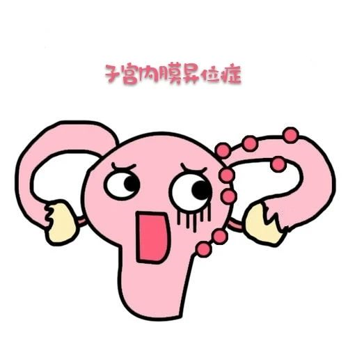 子宫内膜异位征 子宫内膜异位征