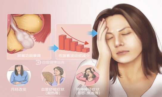 更年期综合征 更年期综合征