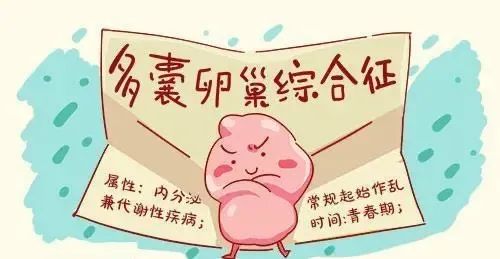 多囊卵巢综合征